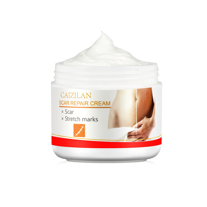 Creme zur Reparatur von Aknenarben für Schwangere, Hautpflege, 30 g