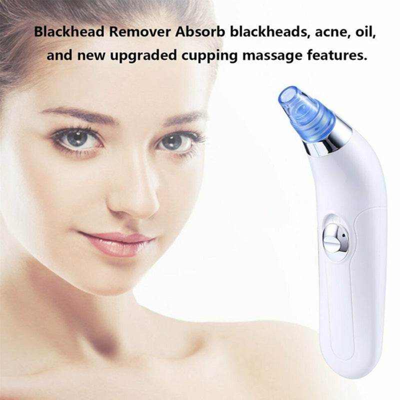 Blackhead Electric Pore Export Blackhead Cleaner