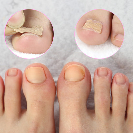 Toe Nail Sticker