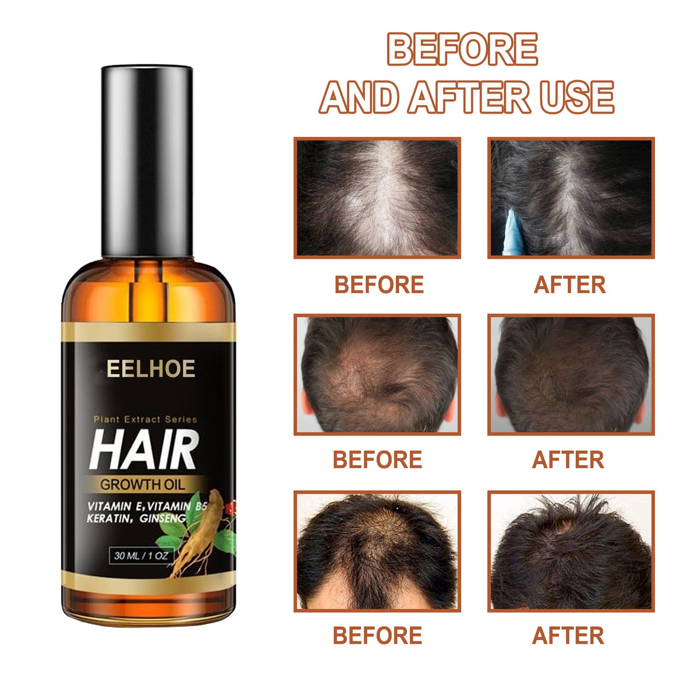 EELHOE Herb Hair Hairdressing Hair Care Essential Oil Hair Strong Hair Reduce Hair Loss Broken Hair Hair Care Essential Oil