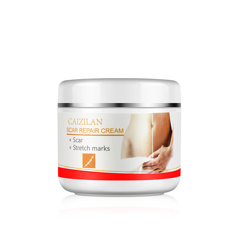 Creme zur Reparatur von Aknenarben für Schwangere, Hautpflege, 30 g