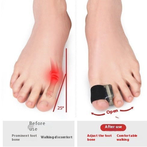 Thumb Valgus Orthosis Big Foot Overlapping Toe Separator