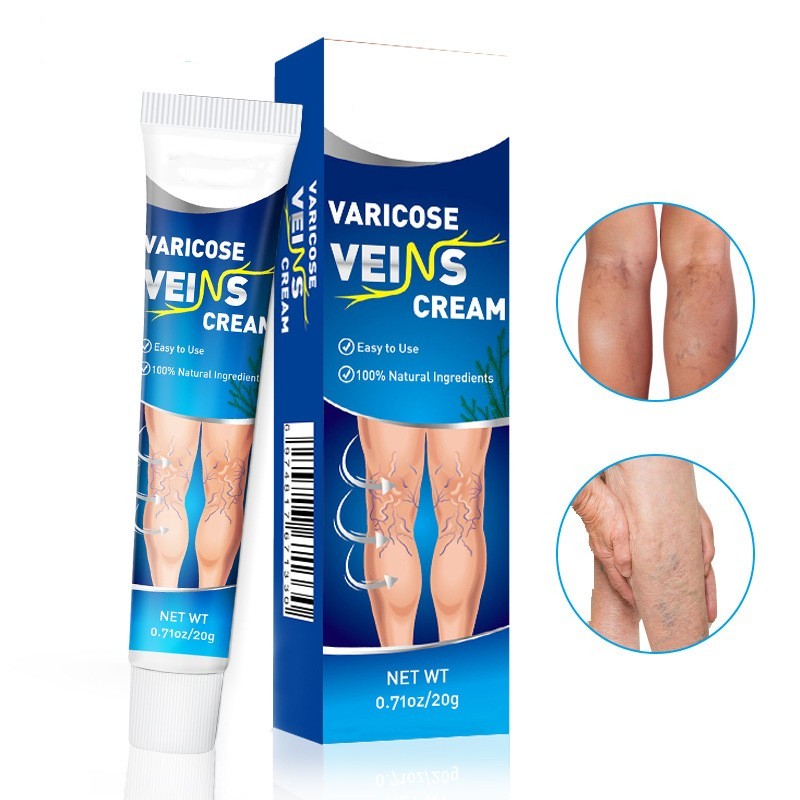 Vein Skin care lotion Shu Soft Earthworm Leg Vascular Tube Cream