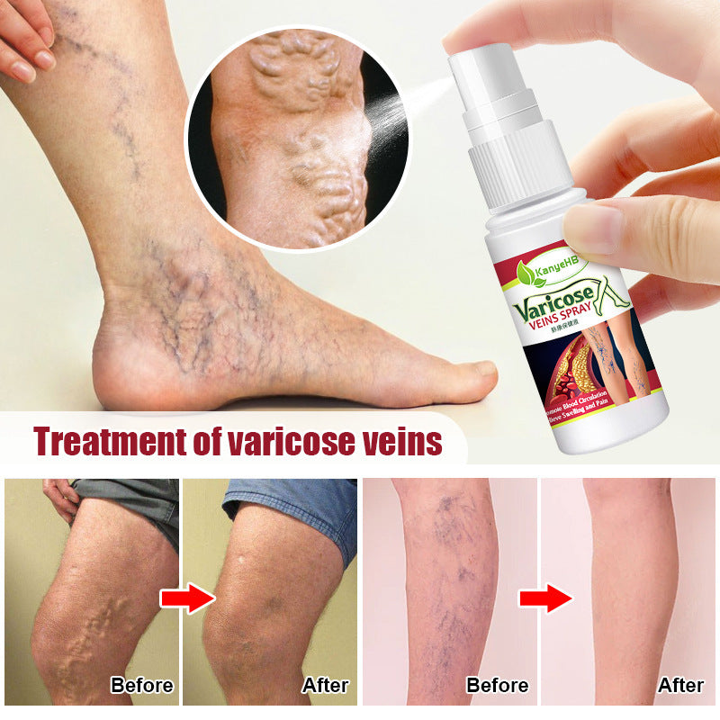 Vein Spray Earthworm Leg Vascular Fluid