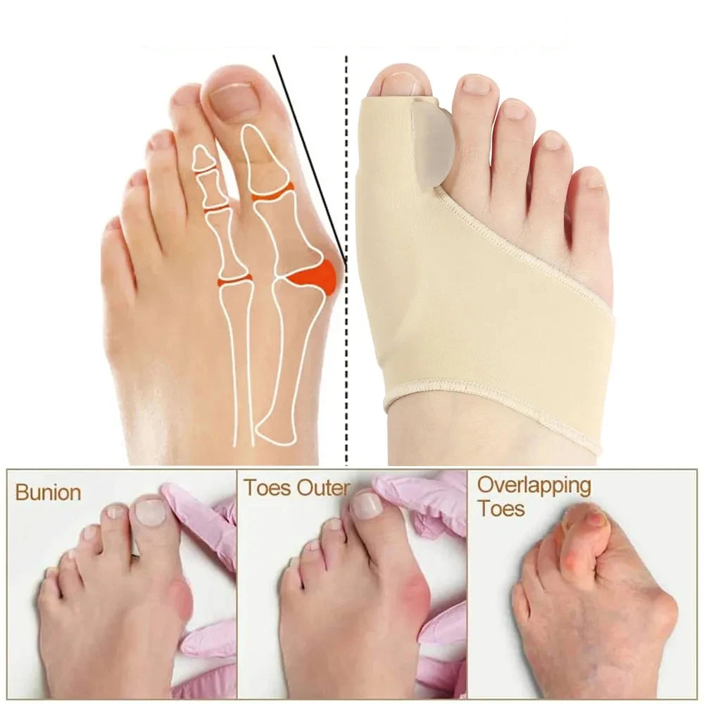 2 Stücke = 1 Paar Big Toe Separator Hallux Valgus Schmerzlinderung Bunion Corrector Frauen Männer Weiche Gel Toe Straightener Orthesen Fußpflege