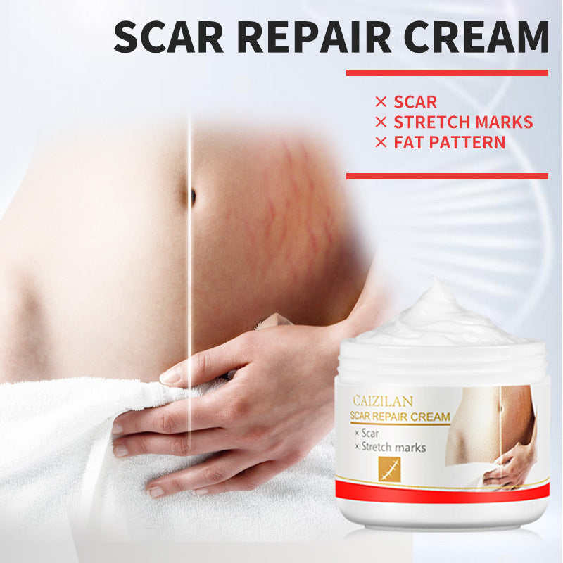 Creme zur Reparatur von Aknenarben für Schwangere, Hautpflege, 30 g